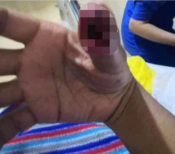 �D���֙C�NĤ�ƕ��p����ָ